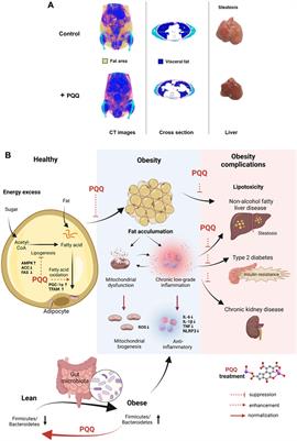 Pyrroloquinoline-quinone to reduce fat accumulation and ameliorate obesity progression